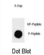 AMOT (pS1041) Antibody