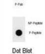 Bcl2-Associated Agonist of Cell Death Phospho-Thr94 (BAD pT94) Antibody