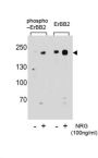 ERBB2 (phospho-Ser1151) Antibody