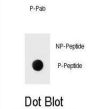 ERBB2 (phospho-Tyr1139) Antibody