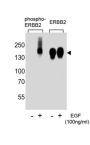 ERBB2 (phospho-Tyr1139) Antibody