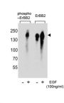 ERBB2 (pY1005) Antibody