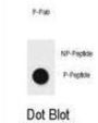 ERBB2 (phospho-Tyr1196) Antibody