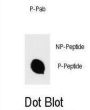 IKKB (pS670) Antibody