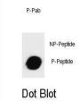 mouse KIT (pT357) Antibody