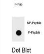 KIT (pT718) Antibody