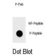 mouse KIT (pS716) Antibody