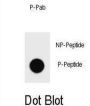 PARP1 (pS177) Antibody