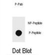 PTEN (pS229) Antibody
