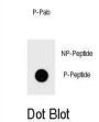 PTEN (pY240) Antibody