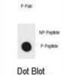 IKKB (pS733) Antibody