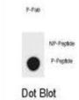 ERBB2 (pS1051) Antibody