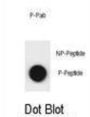 SQSTM1 (pS207) Antibody