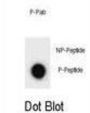 ULK2 (pS323) Antibody