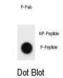 CCNB3 (pT257) Antibody
