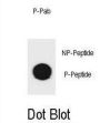 Mouse TSC1 (pS1130) Antibody
