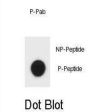 Mouse TSC1 (pS312) Antibody