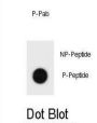 Mouse TSC1 (pS321) Antibody