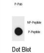 mouse ERBB2 (phospho-Ser1114) Antibody