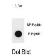 PTEN (pY315) Antibody