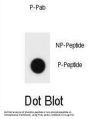 Hamartin Phospho-Ser511 (TSC1 pS511) Antibody