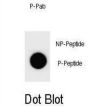 CCNB3 (pS1063) Antibody