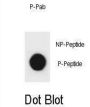 p27Kip1 (pS140) Antibody