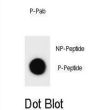 CCND3 (pS264) Antibody