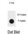 Mouse TSC1 (pS1138) Antibody
