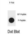 Mouse TSC1 (pT416) Antibody