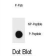 TSC1 (pT390) Antibody