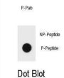 TSC1 (pY297) Antibody