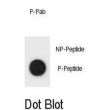 TSC1 (pY304) Antibody