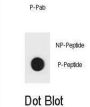 TSC1 (pY312) Antibody