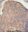 Coiled-Coil Domain-Containing Protein 130 (CC130) Antibody