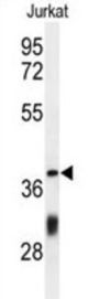 Coiled-Coil Domain-Containing Protein 130 (CC130) Antibody