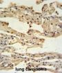 Interferon-Induced Transmembrane Protein 2 (IFM2) Antibody