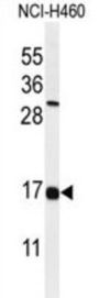 Interferon-Induced Transmembrane Protein 2 (IFM2) Antibody