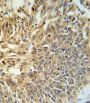 Hypoxia Inducible Factor 1 Alpha (HIF1a) Antibody