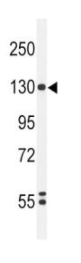 Hypoxia Inducible Factor 1 Alpha (HIF1a) Antibody