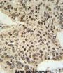 HIST1H2AL Antibody