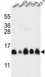 HIST1H2AL Antibody