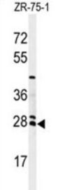 N-Acetyltransferase 8 (NAT8) Antibody