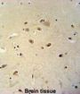 Ras-Related GTP-Binding Protein D (RRAGD) Antibody