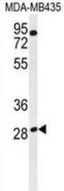 Ras-Related GTP-Binding Protein D (RRAGD) Antibody