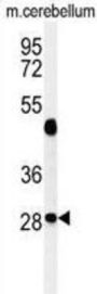 Ras-Related GTP-Binding Protein D (RRAGD) Antibody