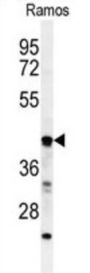B3GALT6 Antibody