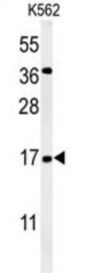 N(Alpha)-Acetyltransferase 50, NatE Catalytic Subunit (NAT13) Antibody