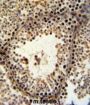 PHF13 Antibody