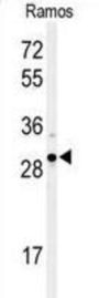 X-Box-Binding Protein 1 (XBP1) Antibody